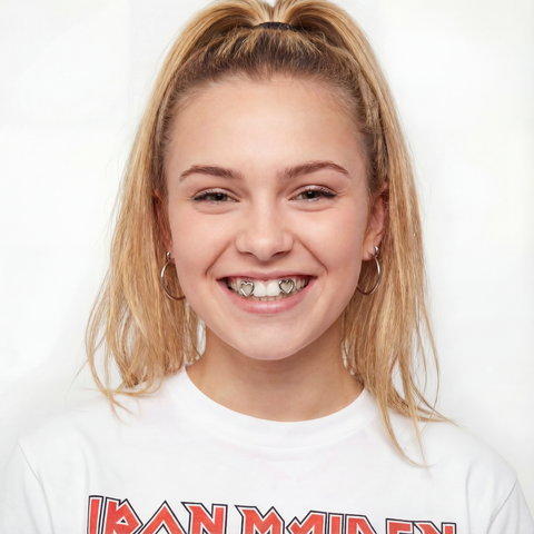 Double Heart Gold Grillz – Minimal Luxury Tooth Jewelry (TOP)